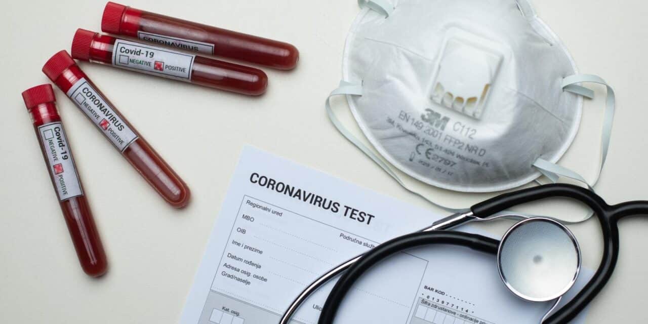 Epruvete s uzorcima krvi – testiranje na koronavirus
