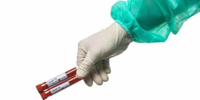 Epruvete s uzorcima krvi – testiranje na koronavirus