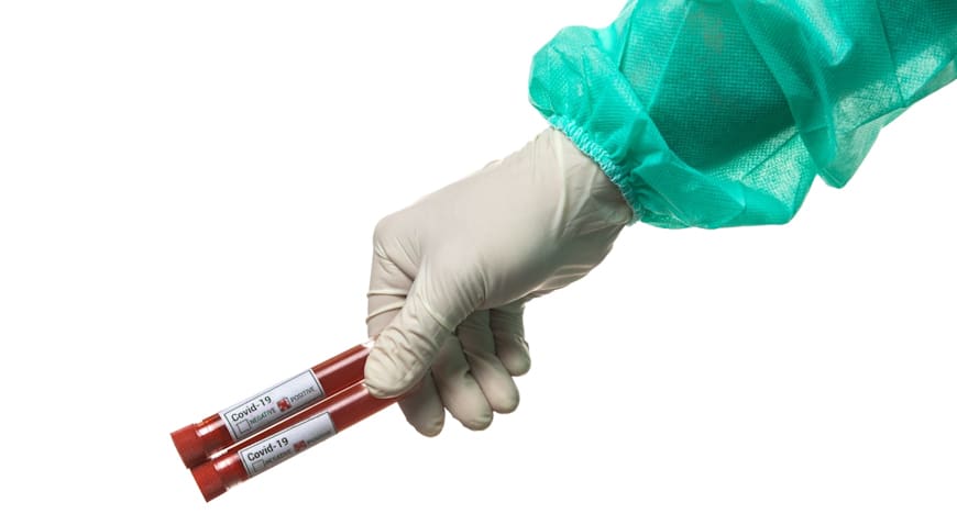 Epruvete s uzorcima krvi – testiranje na koronavirus