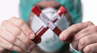 Epruvete s uzorcima krvi – testiranje na koronavirus