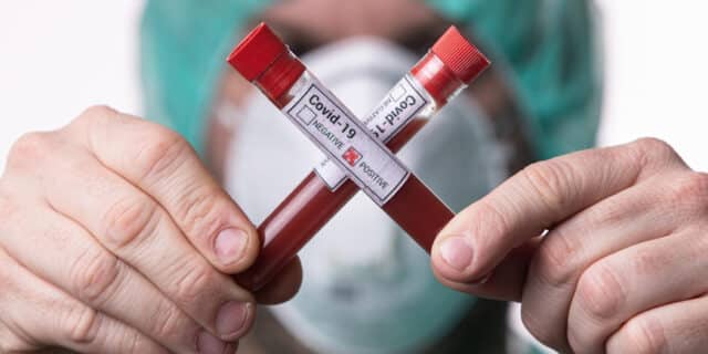 Epruvete s uzorcima krvi – testiranje na koronavirus