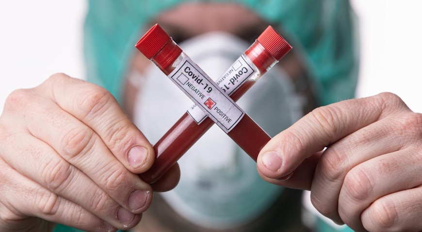 Epruvete s uzorcima krvi – testiranje na koronavirus