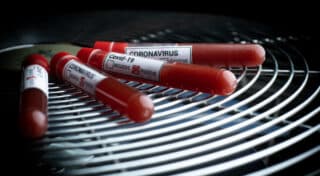 Epruvete s uzorcima krvi – testiranje na koronavirus