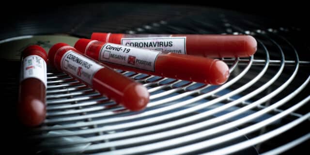 Epruvete s uzorcima krvi – testiranje na koronavirus