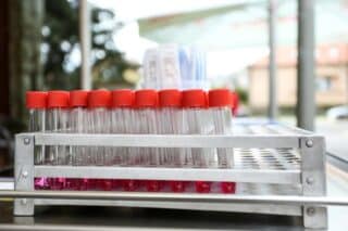 U NZJZ „Dr. Andrija Štampar“ uvedena „drive in“dijagnostika koronavirusa