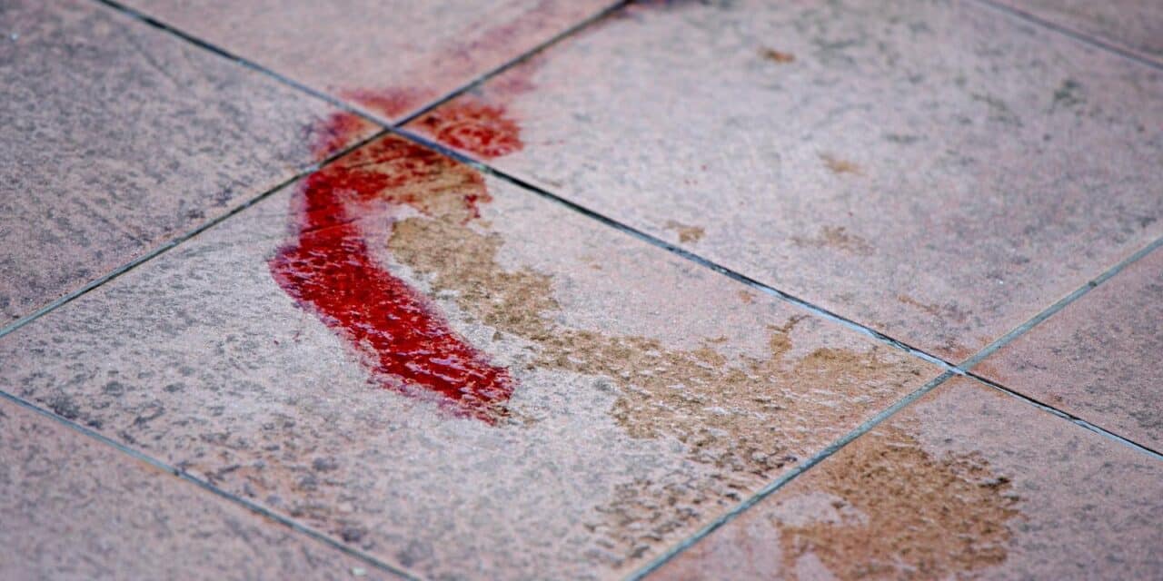 Zagreb: Mu�karac bacio dva psa s tre?eg kata u Prilazu Ivana Visina