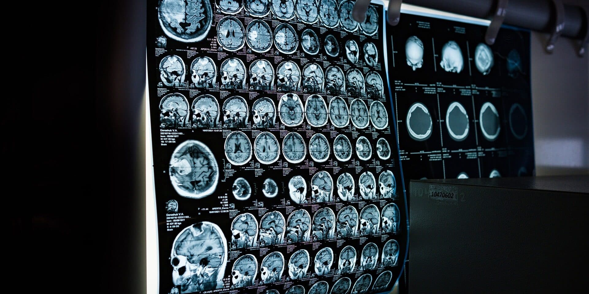 x-ray-6841384_1920