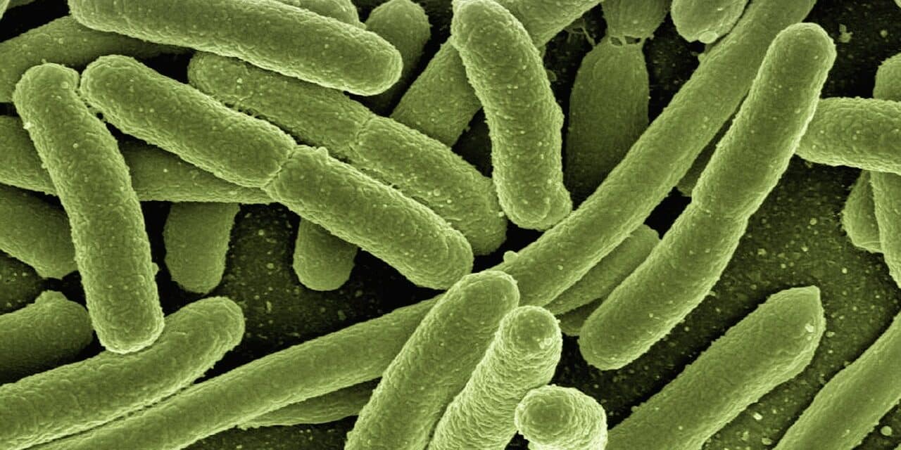 koli-bacteria-123081_1280