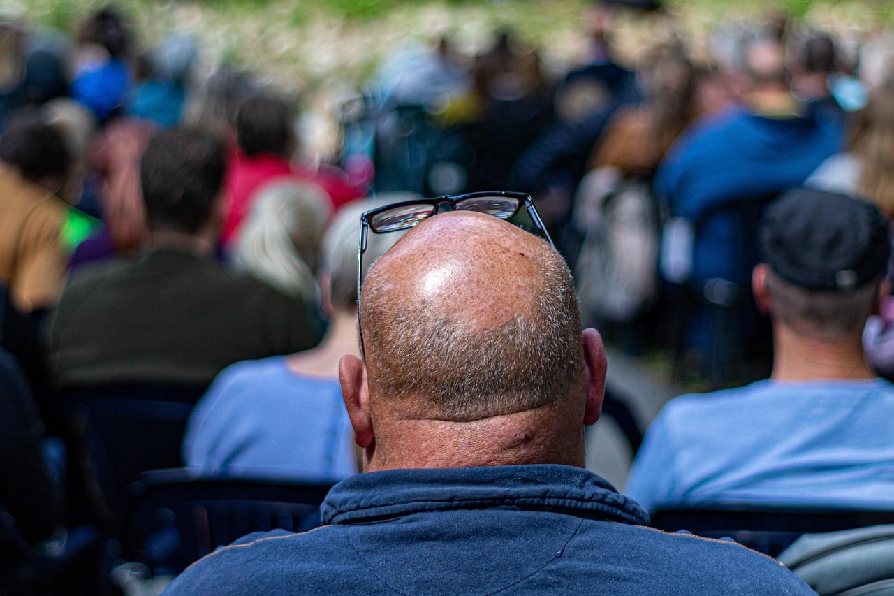 the-balding-4266543_1280